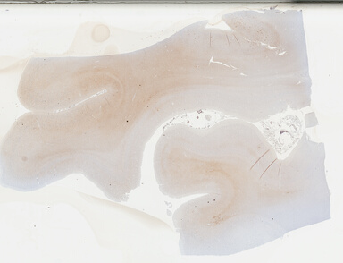 ['deident_7ccfd7d2-85b3-4e4a-9745-ea7d033d1fd8_69b0414c.jpg']