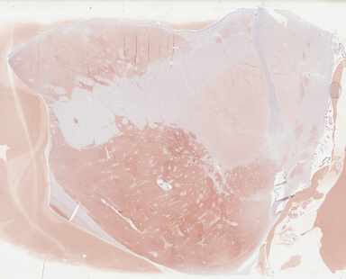['deident_77f333d6-509e-49dd-a683-fa4e23afc1f8_69b0414b.jpg']