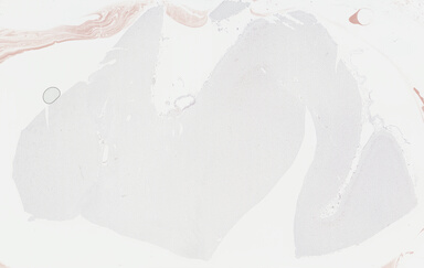 ['deident_c4f92878-ad43-439c-8542-1b8385783b7b_69b04154.jpg']