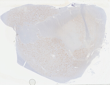 ['deident_28ce0a61-43e1-401b-bf78-dadb1f5f1e10_69b04126.jpg']