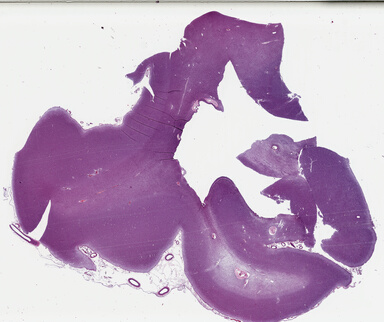 ['deident_f472096f-0347-4490-bf9f-14f6a625851e_69b0416d.jpg']