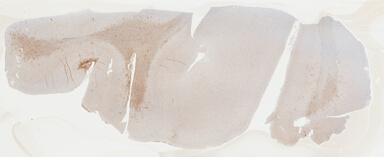 ['deident_dab068d9-bab3-48cc-a0de-60b86e83e9f0_69b04164.jpg']