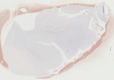 ['deident_be64611b-4083-47bd-8d88-b546885f9398_69b04152.jpg']