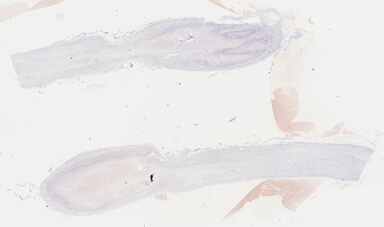 ['deident_6472d37f-31c6-4806-a381-c6f324650adc_69b04146.jpg']