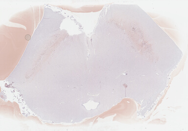 ['deident_3c4fd2e1-14b3-4ed0-a145-9c257aaa240c_69b0412f.jpg']