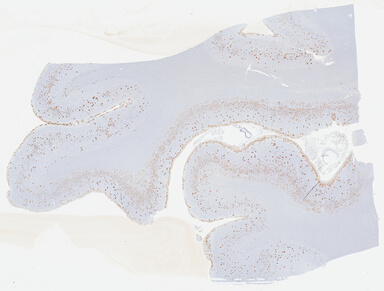 ['deident_429850f0-0214-4108-b083-b7659a1fa22e_69b04138.jpg']
