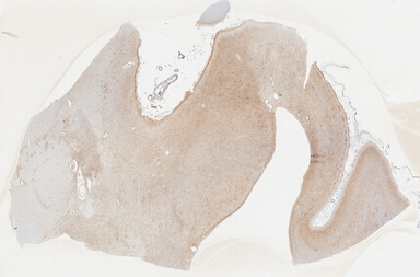 ['deident_d13c9068-aa4f-41ac-b09c-485e1dff91c9_69b04161.jpg']