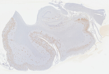 ['deident_5e884ec7-5730-4241-bf74-d7845da5c114_69b04144.jpg']