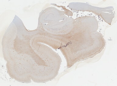 ['deident_6a571bb1-094a-4726-bf11-541fa9e1d5ca_69b04149.jpg']