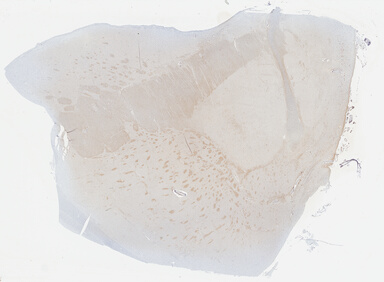 ['deident_1efdf838-f9fd-4b67-aae1-adf84b346c89_69b0411a.jpg']