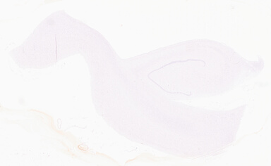 ['deident_028a5bfa-c86e-4d15-abc7-781ba60f8cde_69d92810.jpg']