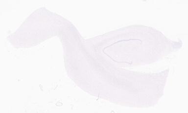 ['deident_20c2f3be-9462-4be5-a356-9f9bc19ab59d_69d9285c.jpg']