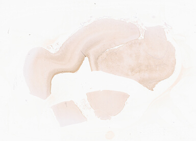 ['deident_8842a4af-19ee-4477-9f83-79bf77d2c916_69d929ff.jpg']