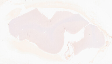 ['deident_ec067e5e-f1e4-4d52-951d-065f05f3e9e3_69d92a84.jpg']