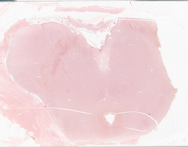 ['deident_2c84bbff-3006-4fe6-98ca-e0a5b25e0022_69d928a0.jpg']