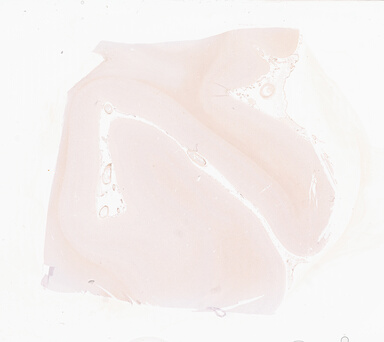 ['deident_f6c1ae4a-e061-4224-9053-87c8f6b0c91e_69d92a93.jpg']