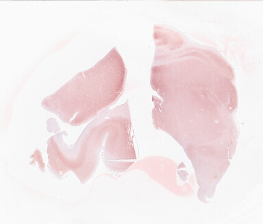 ['deident_0b8e54e7-fcaf-400c-991f-55689b861df1_69d9281a.jpg']