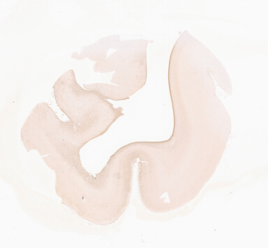 ['deident_57f14ce2-f888-40b2-85b4-f626d6080ddd_69d92902.jpg']
