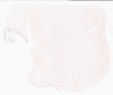 ['deident_b908e609-c50d-4b37-9746-12c3b94bb38d_69d92a44.jpg']