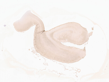 ['deident_88132715-8acb-47cc-804d-09e9922528ab_69d929ce.jpg']