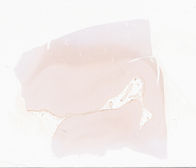 ['deident_a5f1ccc6-ffd5-462a-94f1-2a93d07d719c_69d92a15.jpg']