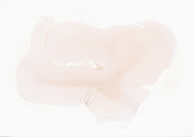 ['deident_e624ee07-9e8e-4cce-9597-7cd4a6ea26f2_69d92a82.jpg']