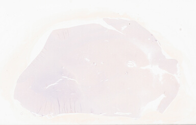 ['deident_570f2bf3-5fce-4ac7-af61-444352f47c6f_69d928d9.jpg']
