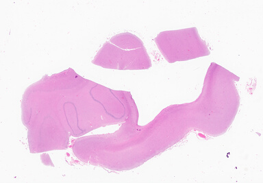 ['deident_3a005a7b-6d44-4e17-895d-86fc5a3c1640_69d928cd.jpg']
