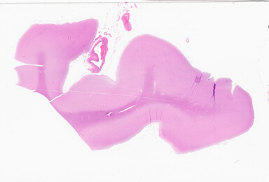 ['deident_70e8cb04-a887-45a9-bf96-39aa591b6b81_69d9298e.jpg']
