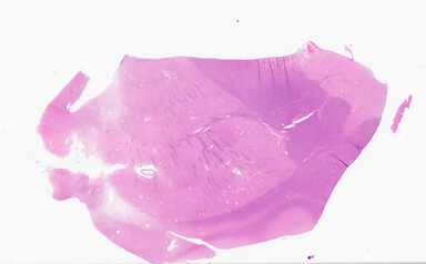 ['deident_a0d49cd1-8cfe-4520-b856-b87b5748c274_69d92a0b.jpg']