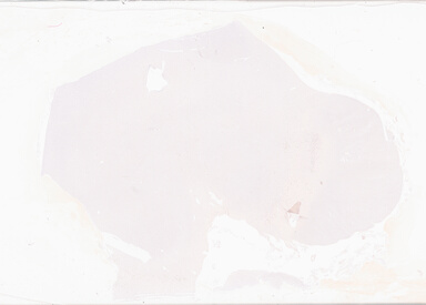 ['deident_29d95ad8-3726-42f6-bd7a-1872707d6d07_69d92898.jpg']