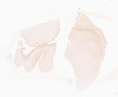 ['deident_cfd41f2c-6731-4866-97ff-bea8596f131e_69d92a49.jpg']