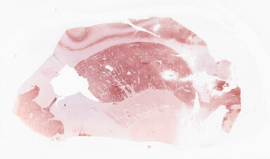 ['deident_f8e0c2eb-560a-4bef-9ec8-7c04ae647345_69d92ad8.jpg']