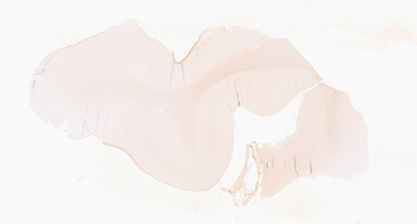 ['deident_deb63bb5-f146-47e9-b254-6d76552fb11f_69d92a4b.jpg']