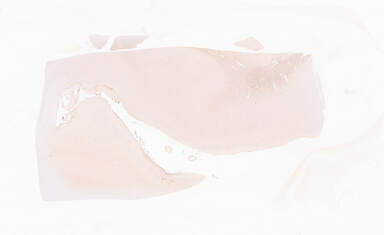 ['deident_f1d20fd5-4d8b-479b-b095-6a6d5de760b0_69d92a87.jpg']