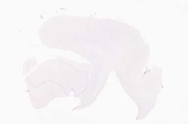 ['deident_a23f64d7-83bf-4311-ab95-18bcdbd8451e_69d92a0e.jpg']
