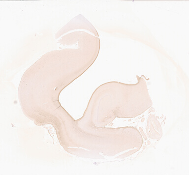 ['deident_c6dfc624-033b-48e9-98fb-2829cc7b56f6_69d92a46.jpg']