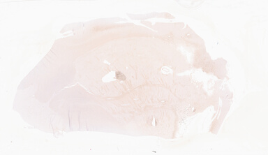 ['deident_84f3f6a7-c9f0-4d2f-8be4-208a33c7d3f7_69d929cb.jpg']