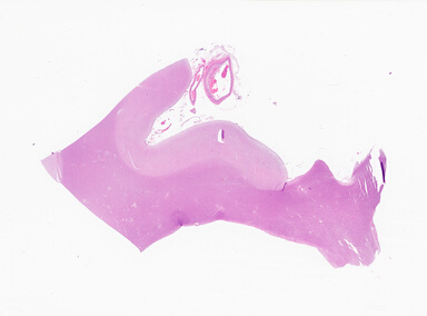 ['deident_52c081dc-1154-40e9-a9a0-41affa35c8cd_69d928d8.jpg']