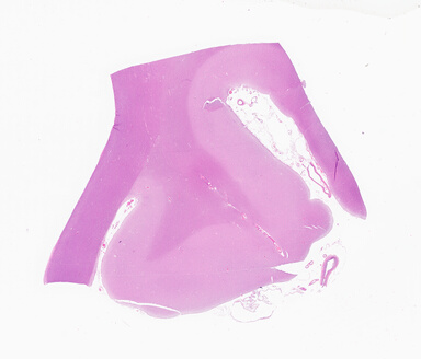 ['deident_9c9333f4-27aa-462f-8922-c0b79dd8d71c_69d92a09.jpg']