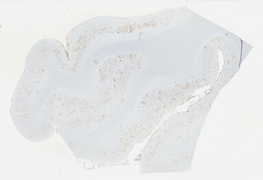 ['deident_bdef9554-ac63-4636-b5a5-3c351dfcf85f_695fcd13.jpg']
