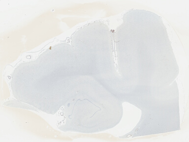 ['deident_e13a3588-d079-456f-bb52-b51676cb1d6e_695fcd24.jpg']