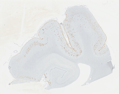 ['deident_d144a2fa-e52b-4d8a-a271-950e82304a46_695fcd1f.jpg']