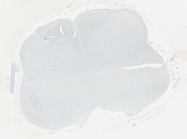 ['deident_5c281cab-9925-4449-9ae4-baaaa5cd40e4_695fcd03.jpg']