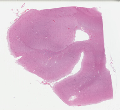 ['deident_3e02da33-6576-4365-872e-1d00b77b5b2d_695fccfc.jpg']