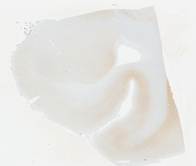 ['deident_38de81c8-b801-40e1-ab0c-7f9d69ba9178_695fccfa.jpg']