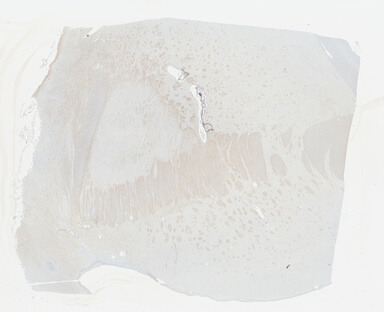 ['deident_dab445cb-2892-4e2e-8765-dcd4b9f32787_695fcd21.jpg']