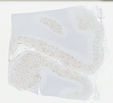 ['deident_b214e630-0cdf-4a2d-ad92-6c2c0f62913c_695fcd12.jpg']