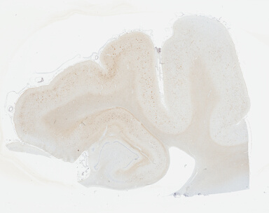 ['deident_19e489bd-4000-4549-9d87-636c979aba05_695fccee.jpg']