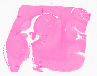 ['deident_dc158d77-4f72-4a2d-b43e-96531a233d6d_69d9673a.jpg']